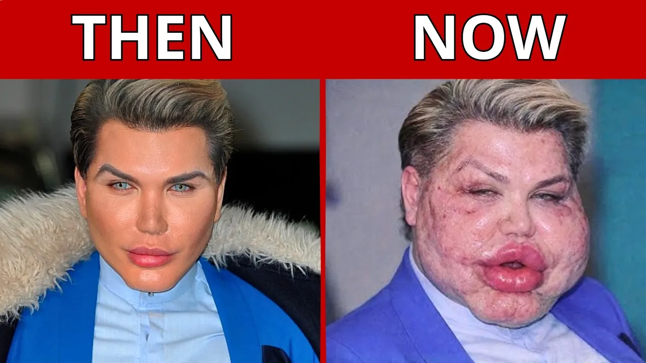 35 Stars Whose Faces Were Changed By Cosmetic Surgery